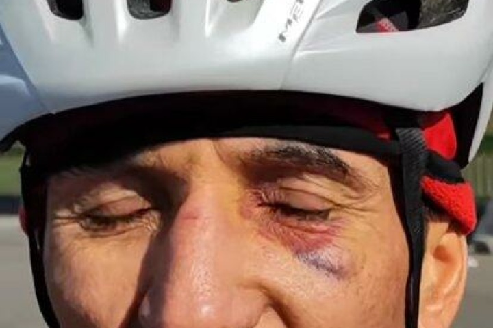 حمله با پنجه بوکس به دوچرخه سوار